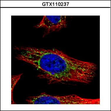GALNS / Chondroitinase Antibody (aa20-259)