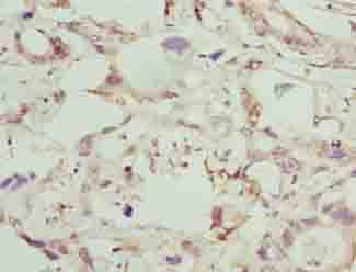 Polyclonal Rabbit anti-Human GGTLA4 / GGTLC1 Antibody (IHC)