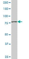 Monoclonal Mouse anti-Human PIK3R1 / p85 Alpha Antibody (clone 1C10, WB)