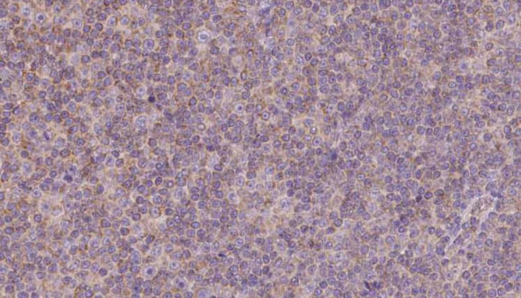 MPZL2 Antibody