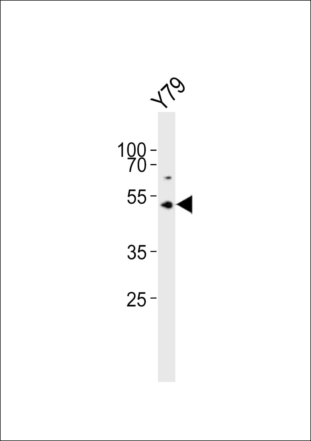 ASMT / HIOMT Antibody (aa212-241)