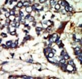 NEK1 Antibody (aa1165-1196)