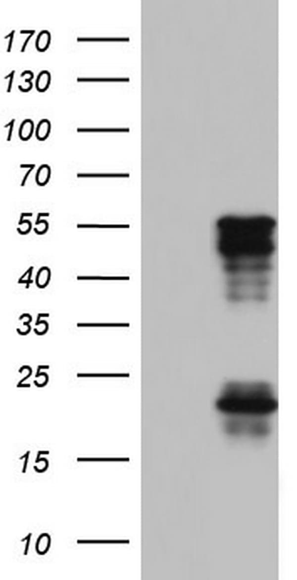 TET3 Antibody (aa241-568, clone OTI2F10)