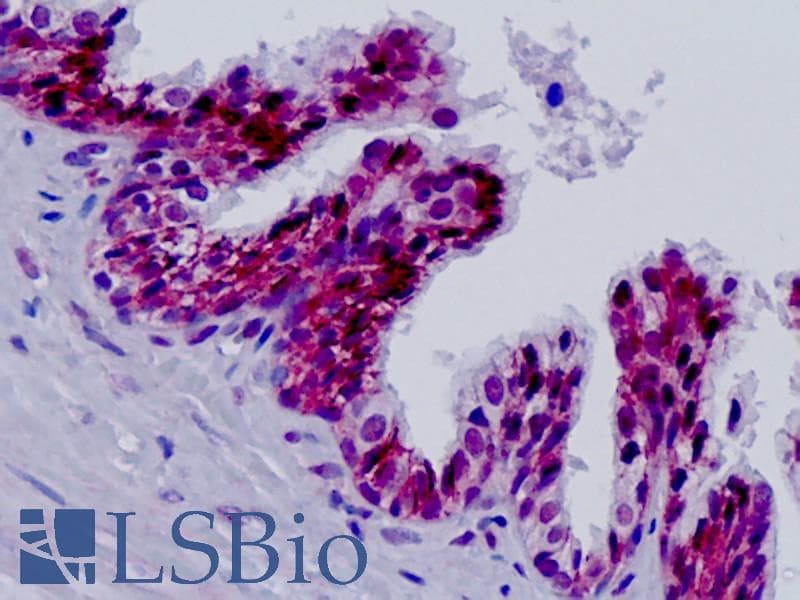 IHC-plus™ Polyclonal Rabbit anti-Human ERCC5 / XPG Antibody (aa131-180, IHC, WB)