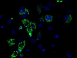 ACO2 / Aconitase 2 Antibody (clone OTI7G4, Carrier-free)