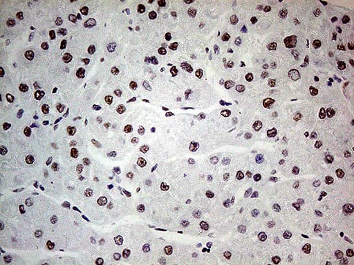 Monoclonal Mouse anti-Human POLR2A / RNA polymerase II Antibody (clone OTI1E5, Carrier-free, aa1351-1614, IHC, WB)