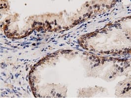 AK5 / Adenylate Kinase 5 Antibody (clone OTI2F9)