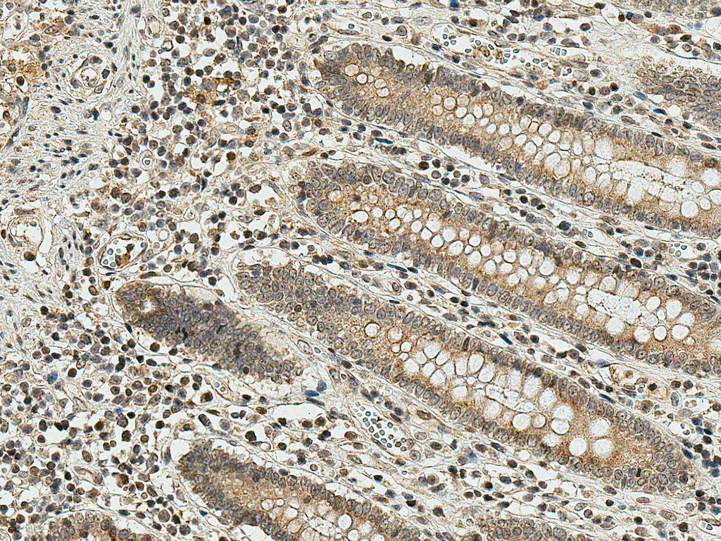SMAD3 Antibody (RPE)