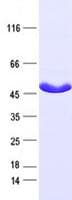 Human IDH2 Protein (Recombinant Myc-DDK (Flag), C-terminus)