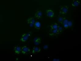 ANXA3 / Annexin A3 Antibody (clone OTI8A12)