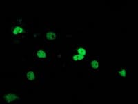 IHC-plus™ SAE2 / UBA2 Antibody (clone 4A3)