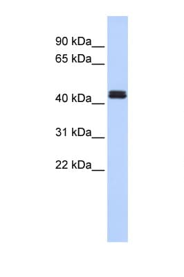 Polyclonal Rabbit anti-Human TRAF1 Antibody (C-Terminus, WB)