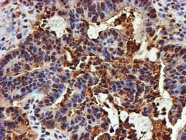 PSMB9 Antibody (clone OTI2B6)