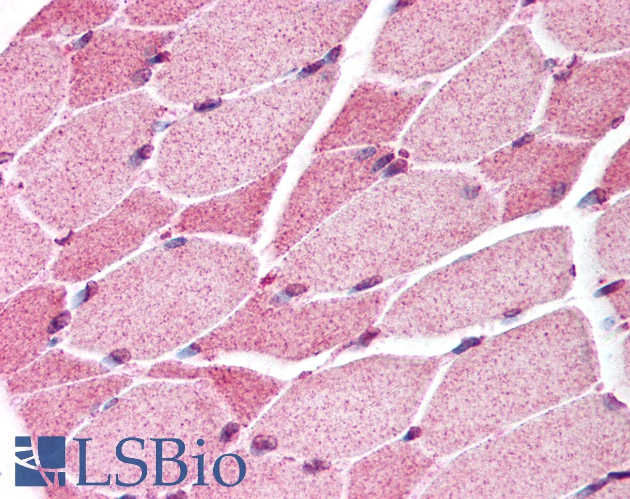 IHC-plus™ Polyclonal Rabbit anti-Human SMAD7 Antibody (aa36-50, IHC, WB)