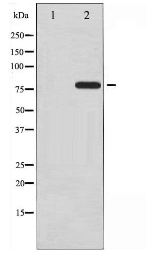 Polyclonal Rabbit anti-Human MAPT / Tau Antibody (phospho-Ser396, WB)