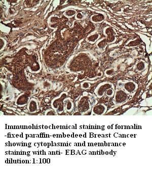 Polyclonal Rabbit anti-Human EBAG9 / RCAS1 Antibody (C-Terminus, IHC)