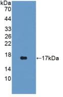 IVL / Involucrin Antibody (aa461-551)