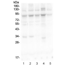 Polyclonal Rabbit anti-Human MLH1 Antibody (WB)