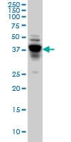 IHC-plus™ Monoclonal Mouse anti-Human NDRG4 Antibody (clone 2G3, IHC, WB)