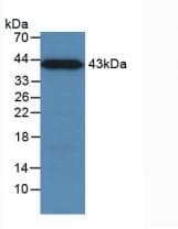 Human MBL2 / Mannose Binding Protein (Recombinant His-GST, N-terminus)