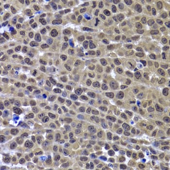 Polyclonal Rabbit anti-Human GPS1 / CSN1 Antibody (IHC, IF, WB)