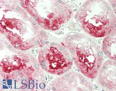 IHC-plus™ CFB / Complement Factor B Antibody (aa23-761)