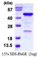 Human HOMER3 / Homer 3 Protein (Recombinant His)