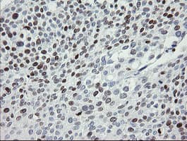 Monoclonal Mouse anti-Human MAFB Antibody (clone OTI2A6, IHC, WB)