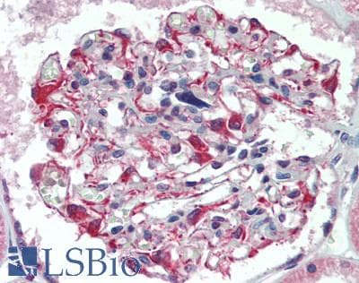 IHC-plus™ SLC25A25 Antibody