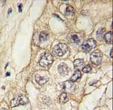 CDH6 / K Cadherin Antibody (aa665-695)