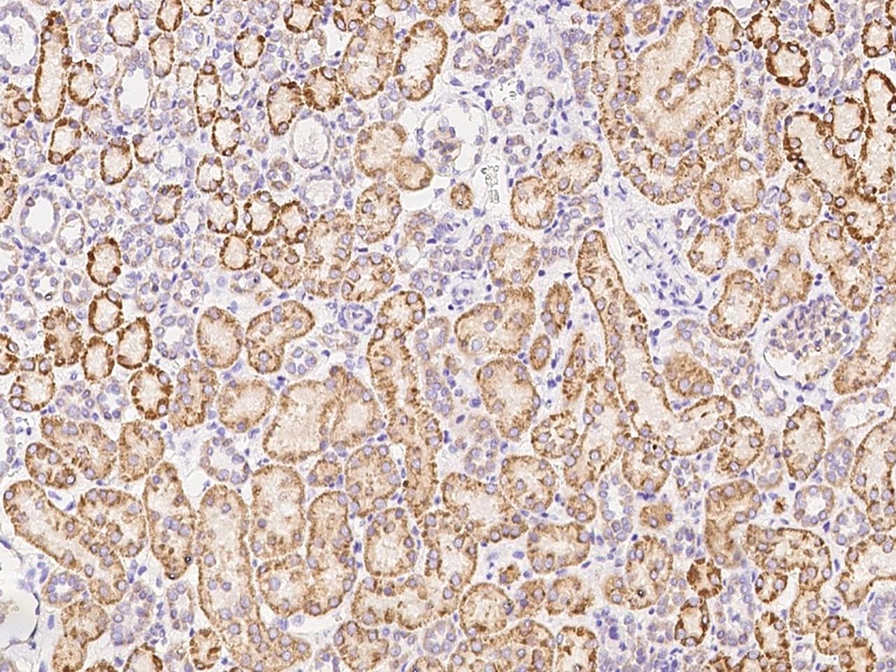 Polyclonal Rabbit anti-Human TRAP1 / HSP75 Antibody (Preservative Free, IHC)