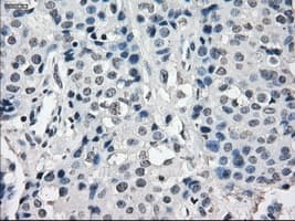 SLC7A8 / LAT2 Antibody (clone OTI7D6)
