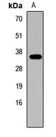 GNRH Antibody