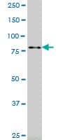Monoclonal Mouse anti-Human RASEF Antibody (clone 2D5, IHC, WB)