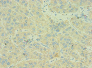 C4BPB / C4BP Beta Antibody (aa18-252)