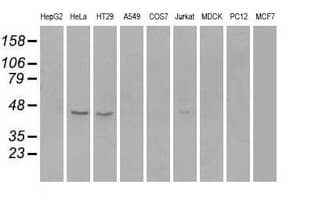RAD9A / RAD9 Antibody (clone OTI7B11)