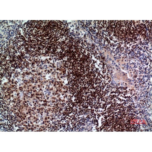 Polyclonal Rabbit anti-Human PAX5 Antibody (161-210 aa, Internal, IHC, WB)