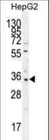 OR52I2 Antibody (aa305-333)