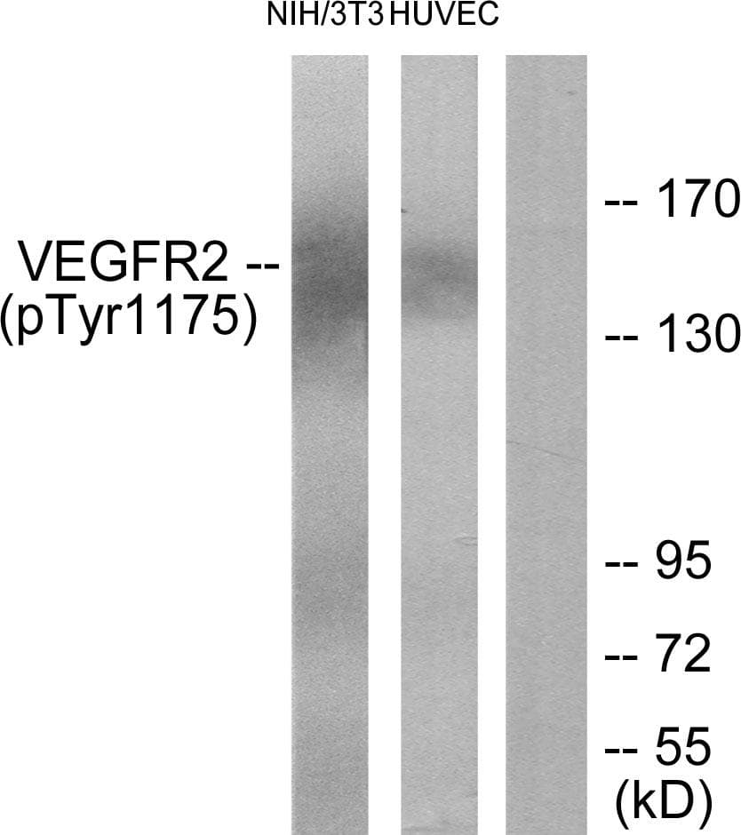 Polyclonal Rabbit anti-Human KDR / VEGFR2 / FLK1 Antibody (phospho-Tyr1175, IHC, WB)