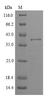 Phleum pratense Pollen allergen Phl p 5b Protein (Recombinant 6His-SUMO, N-terminus)