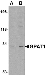 IHC-plus™ GPAM Antibody