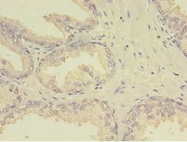 MTHFR Antibody (aa1-656)