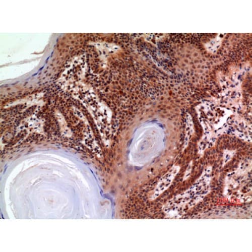 A2M / Alpha-2-Macroglobulin Antibody (Internal)