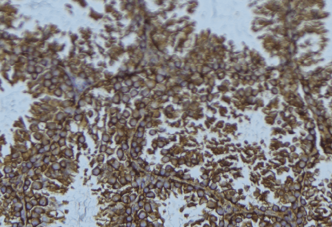 SNX9 / WISP Antibody