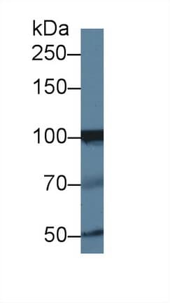 INPP4A Antibody (aa1-137, Biotin)