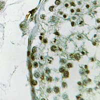 UBQLN3 Antibody (Internal)