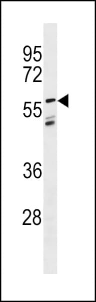LGI3 Antibody (aa310-338)