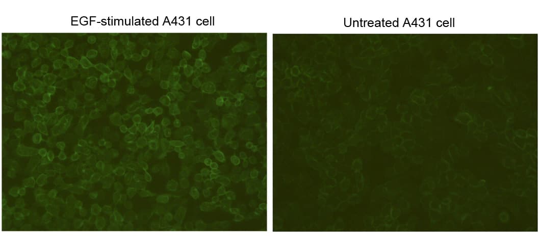 Phosphotyrosine Antibody
