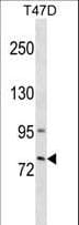 Polyclonal Rabbit anti-Human GLB1L3 Antibody (aa475-501, WB)