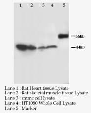 P2RX3 / P2X3 Antibody (C-Terminus, Sepharose)